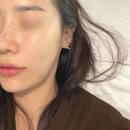 리리스 에스테틱 | [리뷰]강남 역삼동 피부관리 리리스에스테틱 탄력관리 후기