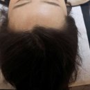 홍 헤어라인 이미지