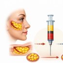 티포인트성형외과의원 | 강남눈밑지방재배치, 도자기의원 멀리서 찾아오시는 이유가 있습니다