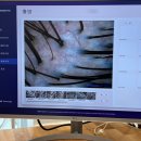 오즈스윗홈 | 전문적인 두피클리닉샵 광교 두피관리 오즈헤어&amp;두피클리닉