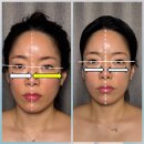 척추밸런스카이로필라테스 | 청담 안면 비대칭 교정 리얼 후기 입안 근육 광대까지 잡아주는 정밀 관리