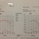 보청기KS 이미지