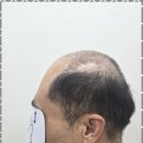 커트앤도트