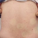 미소로한의원 이미지