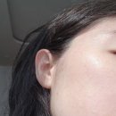 연세보드미의원 네이버블로그