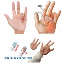 신흥수지 이미지