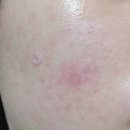 동그랗개 이미지