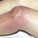 수원고려본정형외과의원 이미지