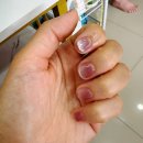 네일 퀸(Nail Queen)