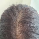 수헤어라인 이미지