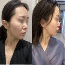 대구 달서구 감삼동 피부관리 미본가 방문후기