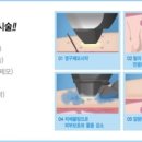 소프라노의원 이미지