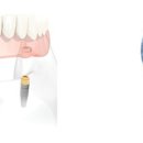 삼성 치과기공소 이미지