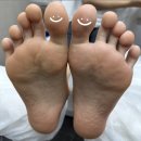 금손 다스림센터 | 여름대비 발 각질관리 &amp; 풋케어 후기