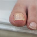 굿네일 | 양주 옥정동 내성발톱 맞춤관리 대만족 후기 굿네일