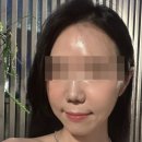 홍대앞헤어&스킨 | 홍대피부과 스킨부스터 쥬브아셀, 눈밑·앞볼 볼륨 관리 후기