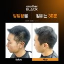 시엔헤어지사점 | 대전 탈모관리 및 눈썹수강은 페이스터치에서~!!