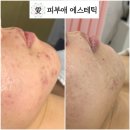 피부애 - 동구 율하동 | 피부애