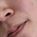 봉정로 | 성정동왁싱 왜 이제야 갔을까? 천안왁싱 비바유왁싱 겨드랑이 인중왁싱 리얼후기