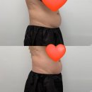 통탈라이프케어 | 경기광주마사지 이프유스킨 뉴로클래식 복부관리로 다이어트 체형관리 완성!