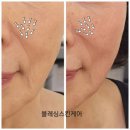 문스킨케어 이미지