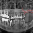 서울석치과의원 이미지