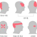 자고 일어나면 두통, 그 원인은? (낮잠두통, 수면부족, 어지러움) 이미지