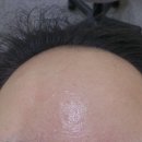 신지정로 | 원주 기업도시 피부관리샵 추천｜뷰티온 스페셜 트러블케어 후기