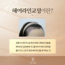 줌헤어라인
