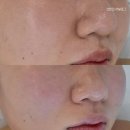 하로스파 | 수유역피부관리 하로스파 페이셜관리 후기