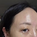 다솜에너지 | [일산 피부관리] 백석역 다솜에스테틱 물광 수분관리 후기