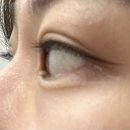 중흥한방병원 | 맞춤형 광주속눈썹 멉지뷰치 첨단속눈썹펌 후기