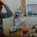 중증 루푸스 생물학적제제,면역억제제 이미지