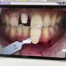 뉴치과기공소 이미지