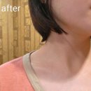 노랑나비 | [25주차]임산부 대구산전마사지 후기 •노랑나비풋앤바디•