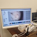 분당-98 | 분당 두피관리 셀비오 분당점 | 옆머리 탈모 지수 98% 충격... 야탑 셀비오 분당점에서 심폐소생술 받고...