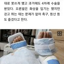 의료 과실 사고 멀쩡한 오른발목 절단! 이미지