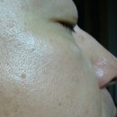 (주)토아스 | 미백 기능성화장품 토아스 미라클 인텐스 비타민 C앰플 사용후기