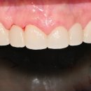 엄지치과기공소 이미지