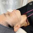 에네스스킨