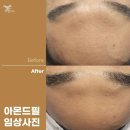 더맑은스킨(매곡점)