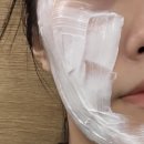 모즈의원 | 압구정피부과 모즈 클리닉 비타란 물광주사 맞아봤어요!