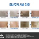 마법의약국 네이버블로그