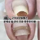 풋풋한리쌤 성수본점 | 군자내성발톱은 문제성 발 관리 전문 풋풋한리쌤!