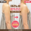 유니에스테틱 | 부산팔뚝관리 유니유에스테틱 테라노바로 정리한 드레스라인 후기