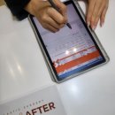 니트성형외과의원 | 코성형 전문병원에서 상담받고 온 후기 [강남역 니트성형외과]