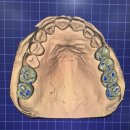 애프터기공소 이미지