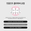 현플란트치과의원 네이버블로그