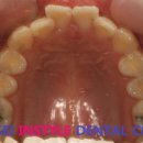 CORE 치과기공소 이미지