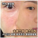 그린메디칼 | 불당동 피부관리 솔에스떼 AI 정밀진단 물광플럼핑 속건조 후기